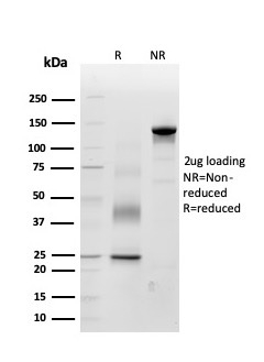 SDS-PAGE Analysis Purified Periostin (POSTN) Mouse Monoclonal Antibody (POSTN/3503). Confirmation of Purity and Integrity of Antibody.
