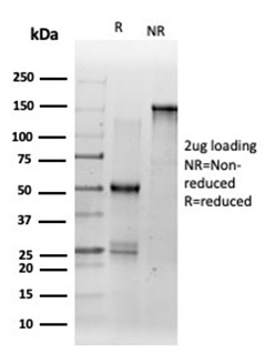 SDS-PAGE Analysis. Purified DMRT2 Mouse Monoclonal Antibody (PCRP-DMRT2-1B11). Confirmation of Integrity and Purity of Antibody.