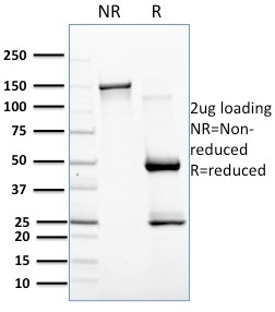 SDS-PAGE Analysis of Purified CD257 Mouse Monoclonal Antibody (C257/1638). Confirmation of Purity and Integrity of Antibody.
