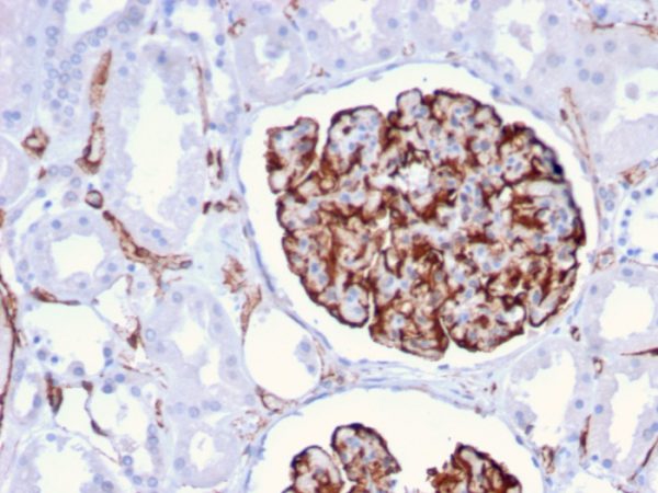 Formalin-fixed, paraffin-embedded human Kidney stained with Nestin Mouse Monoclonal Antibody (NES/2911).