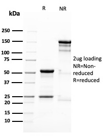 SDS-PAGE Analysis Purified Nestin Mouse Monoclonal Antibody (NES/2911). Confirmation of Purity and Integrity of Antibody.