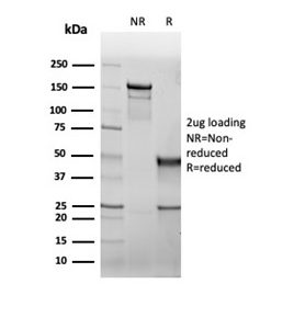 SDS-PAGE Analysis of Purified CFTR Recombinant Mouse Monoclonal Antibody (rCFTR/6476). Confirmation of Purity and Integrity of Antibody.