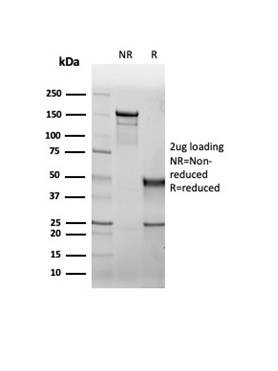 SDS-PAGE Analysis Purified CFTR Recombinant Mouse Monoclonal Antibody (rCFTR/6476). Confirmation of Purity and Integrity of Antibody.