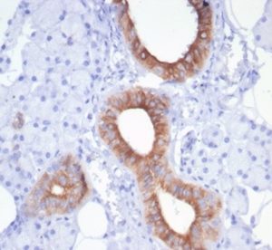 IHC analysis of formalin-fixed, paraffin-embedded human salivary gland. Stained using rCFTR/7175 at 2ug/ml. HIER: Tris/EDTA, pH9.0, 45min. HIER: Tris/EDTA, pH9.0, 45min. 2 °: HRP-polymer, 30min. DAB, 5min.
