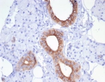 IHC analysis of formalin-fixed, paraffin-embedded human salivary gland. Stained using rCFTR/7175 at 2ug/ml. HIER: Tris/EDTA, pH9.0, 45min. HIER: Tris/EDTA, pH9.0, 45min. 2 °: HRP-polymer, 30min. DAB, 5min.
