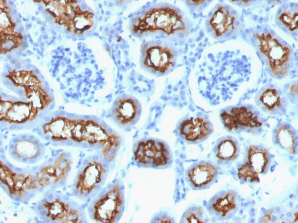 Formalin-fixed, paraffin-embedded Mouse Kidney stained with CFTR Monoclonal Antibody (CFTR/1342).