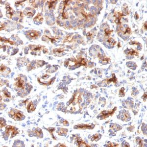 Formalin-fixed, paraffin-embedded human Pancreas stained with CFTR Monoclonal Antibody (SPM176).