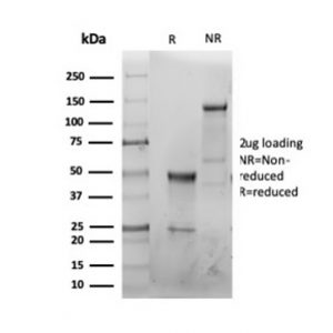SDS-PAGE Analysis of Purified CFTR Recombinant Rabbit Monoclonal Antibody (CFTR/6477R). Confirmation of Purity and Integrity of Antibody.