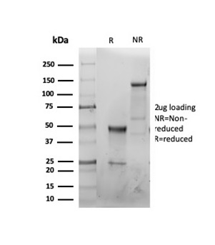 SDS-PAGE Analysis Purified CFTR Recombinant Rabbit Monoclonal Antibody (CFTR/6477R). Confirmation of Purity and Integrity of Antibody.