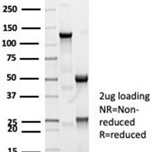 SDS-PAGE Analysis of Purified CFTR Recombinant Rabbit Monoclonal Antibody (CFTR/7003R). Confirmation of Purity and Integrity of Antibody.