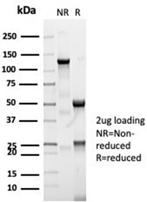 SDS-PAGE Analysis Purified CFTR Recombinant Rabbit Monoclonal Antibody (CFTR/7003R). Confirmation of Purity and Integrity of Antibody.