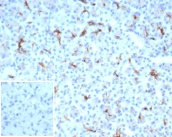 Formalin-fixed, paraffin-embedded human spleen stained with CFTR Recombinant Rabbit Monoclonal Antibody (CFTR/7003R). Inset: PBS instead of primary antibody; secondary only negative control.