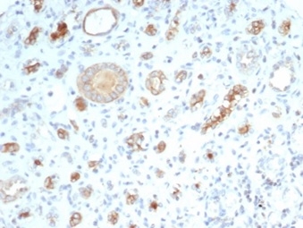 Formalin-fixed, paraffin-embedded human kidney stained with CFTR Recombinant Rabbit Monoclonal Antibody (CFTR/7003R). Inset: PBS instead of primary antibody; secondary only negative control.