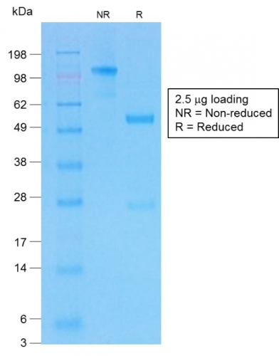 SDS-PAGE Analysis of Purifed CFTR Rabbit Recombinant Monoclonal Antibody (CFTR/1775R).