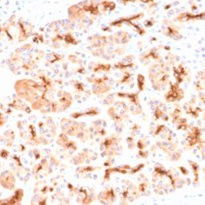 Formalin-fixed, paraffin-embedded human Pancreas stained with CFTR Rabbit Recombinant Monoclonal Antibody (CFTR/2290R).