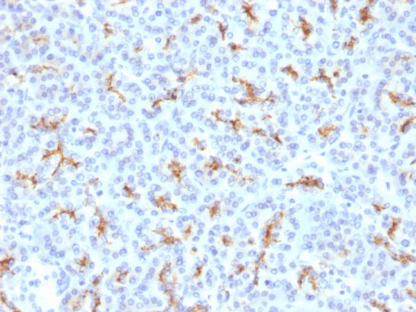 Formalin-fixed, paraffin-embedded human Pancreas stained with CFTR Rabbit Polyclonal Antibody.