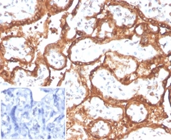 Formalin-fixed, paraffin-embedded human placenta stained with HCG-alpha Rabbit Recombinant Monoclonal Antibody (HCGa/2728R). Inset: PBS instead of primary antibody; secondary only negative control.
