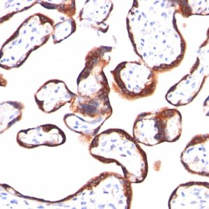 Formalin-fixed, paraffin-embedded human Placenta stained with hCG beta Mouse Monoclonal Antibody (HCGb/459).