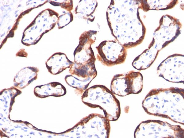 Formalin-fixed, paraffin-embedded human Placenta stained with hCG beta Mouse Monoclonal Antibody (HCGb/459).