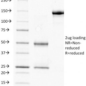 SDS-PAGE Analysis of Purified HCG-beta Mouse Monoclonal Antibody (HCGb/211). Confirmation of Purity and Integrity of Antibody.