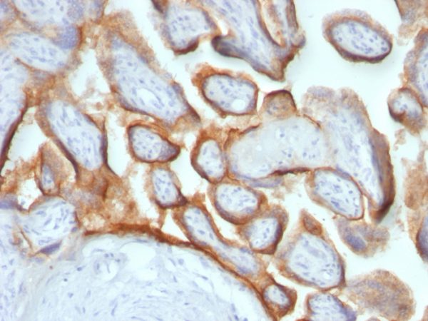 Formalin-fixed, paraffin-embedded human Placenta stained with hCG beta Mouse Monoclonal Antibody (HCGb/54 + HCGb/459).