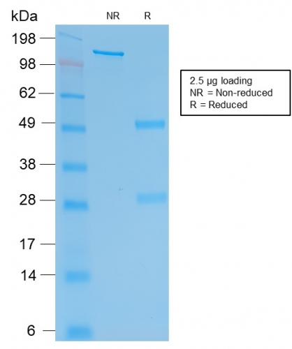 SDS-PAGE Analysis Purified hCG beta Mouse Recombinant Monoclonal Antibody (rHCGb/54). Confirmation of Purity and Integrity of Antibody.