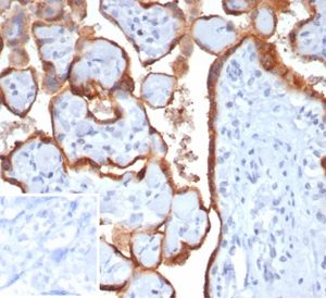 Formalin-fixed, paraffin-embedded human placenta stained with HCGb Recombinant Rabbit Monoclonal Antibody (HCGb/7201R). Inset: PBS instead of primary antibody; secondary only negative control.