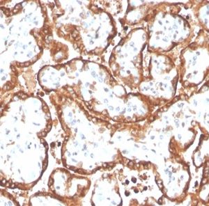 Formalin-fixed, paraffin-embedded human placenta stained with HCGb Rabbit Recombinant Monoclonal Antibody Cocktail (HCGb/4709R).