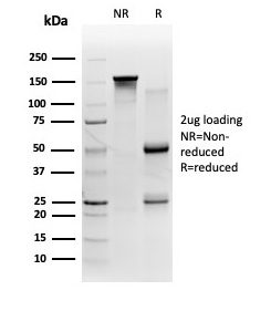 SDS-PAGE Analysis Purified 58K Golgi Protein Mouse Monoclonal (FTCD/357). Confirmation of Integrity and Purity of Antibody.