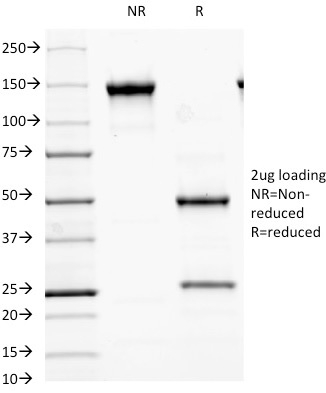 SDS-PAGE Analysis of Purified MALT1 Mouse Monoclonal Antibody (MT1/410). Confirmation of Purity and Integrity of Antibody.