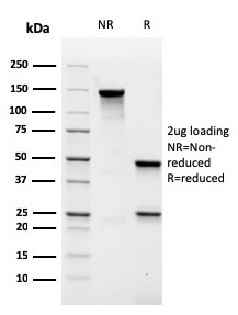 SDS-PAGE Analysis of Purified MALT1 Recombinant Mouse Monoclonal Antibody (rMT1/410). Confirmation of Purity and Integrity of Antibody.