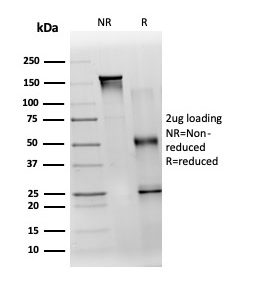 SDS-PAGE Analysis of Purified TDRKH Mouse Monoclonal Antibody (PCRP-TDRKH-1H2). Confirmation of Purity and Integrity of Antibody.