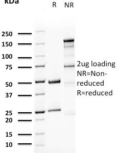 SDS-PAGE Analysis of Purified Uroplakin 1A Mouse Monoclonal Antibody (UPK1A/2923). Confirmation of Purity and Integrity of Antibody.