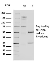SDS-PAGE Analysis of Purified Uroplakin 1A Mouse Monoclonal Antibody (UPK1A/2924). Confirmation of Purity and Integrity of Antibody.