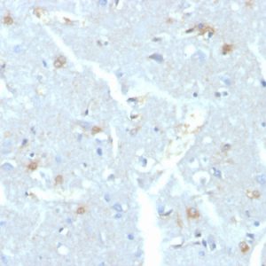 Formalin-fixed, paraffin-embedded human brain stained with UBE2C Mouse Monoclonal Antibody (CPTC-UBE2C-1)