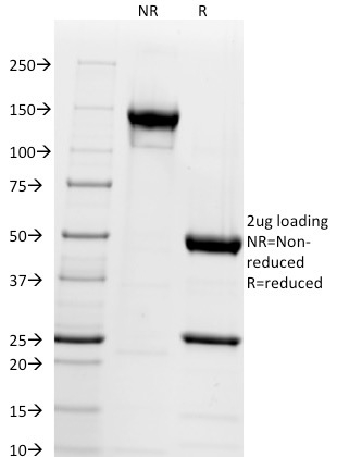 SDS-PAGE Analysis Purified Chromogranin A Mouse Monoclonal Antibody (CGA/414).