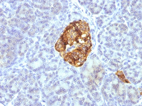 Formalin-fixed, paraffin-embedded Pancreas stained with Chromogranin A Monoclonal Antibody (CGA/413+ CHGA/777+ CHGA/798)