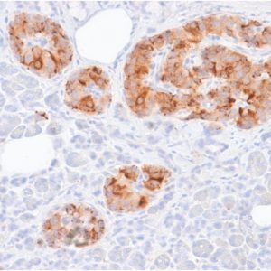 Formalin-fixed, paraffin-embedded human pancreas stained with  Chromogranin A Mouse Recombinant Monoclonal Ab (rCHGA/413). HIER: Tris/EDTA, pH9.0, 45min. 2°C: HRP-polymer, 30min. DAB, 5min.