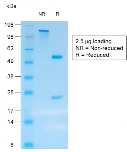 SDS-PAGE Analysis Purified Chromogranin A Mouse Recombinant Monoclonal Ab (rCHGA/413). Confirmation of Purity and Integrity of Antibody.