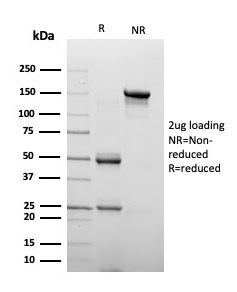 SDS-PAGE Analysis Chromogranin A Mouse Monoclonal Antibody (CHGA/4223). Confirmation of Purity and Integrity of Antibody.