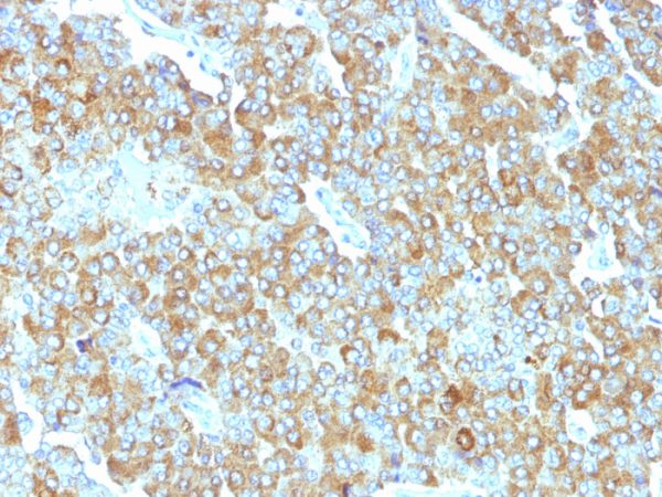 Formalin-fixed, paraffin-embedded human Adrenal Gland stained with Chromogranin A Mouse Monoclonal Antibody (PHE5).