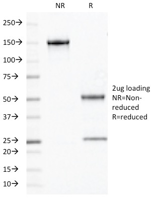 SDS-PAGE Analysis Purified Chromogranin A Mouse Monoclonal Antibody (PHE5). Confirmation of Purity and Integrity of Antibody.