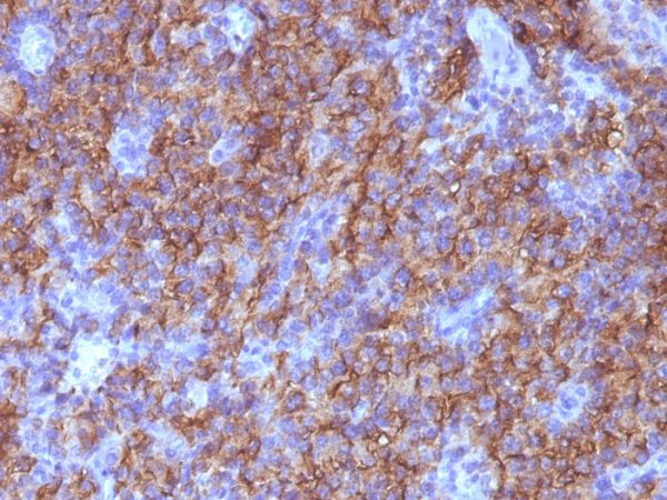 Formalin-fixed, paraffin-embedded human Parathyroid stained with Chromogranin A Monoclonal Antibody (CHGA/765).