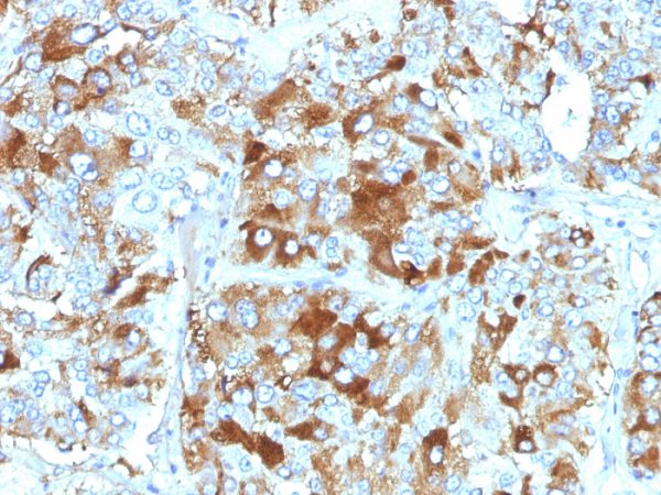 Formalin-fixed, paraffin-embedded human Adrenal Gland stained with Chromogranin A Monoclonal Antibody (CHGA/765).