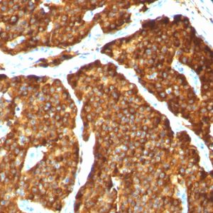 Formalin-fixed, paraffin-embedded human Pheochromocytoma stained with Chromogranin A Mouse Monoclonal Antibody (CHGA/777)