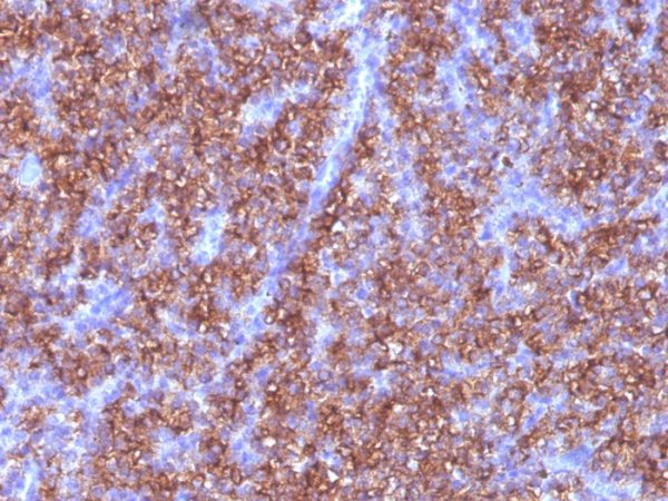 Formalin-fixed, paraffin-embedded human Parathyroid stained with Chromogranin A Monoclonal Antibody (CGA/413)