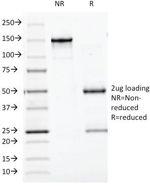 SDS-PAGE Analysis Purified Chromogranin A Monoclonal Antibody (CGA/413). Confirmation of Integrity and Purity of Antibody.