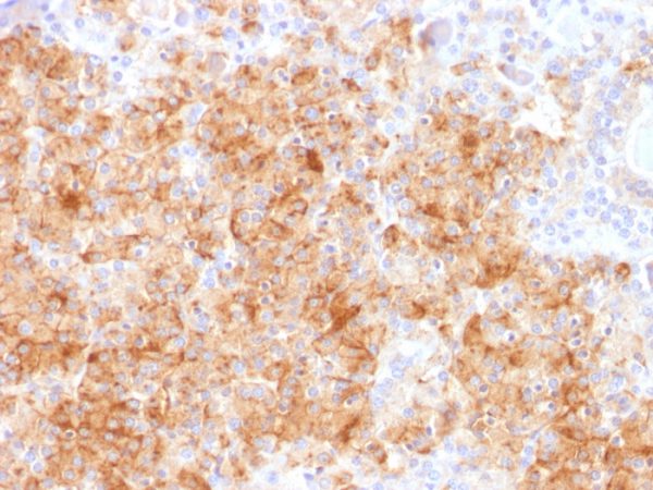 Formalin-fixed, paraffin-embedded human Parathyroid stained with Chromogranin A Rabbit Recombinant Monoclonal Ab (CHGA/1731R).