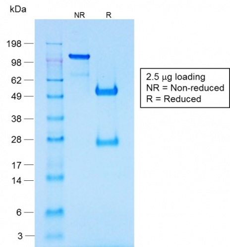 SDS-PAGE Analysis of Purified Chromogranin A Rabbit Recombinant Monoclonal Antib (CHGA/1731R). Confirmation of Purity and Integrity.