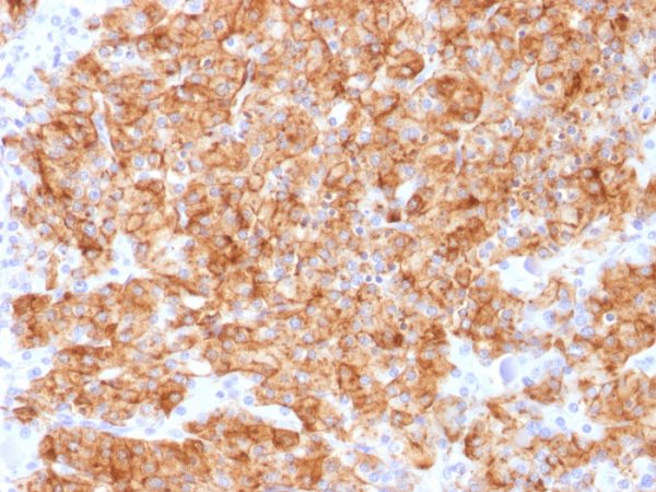 Formalin-fixed, paraffin-embedded human Parathyroid stained with Chromogranin A Rabbit Recombinant Monoclonal Antibody (CHGA/1773R).